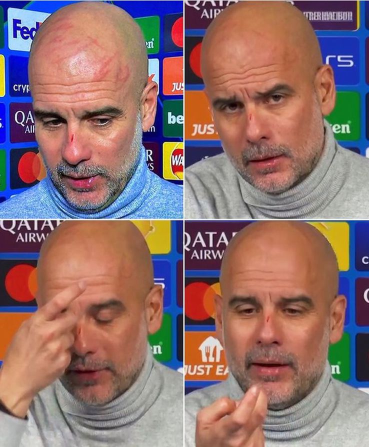 Rănile lui Guardiola